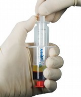 PRP injection for tennis elbow